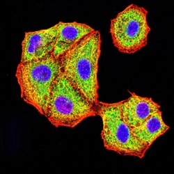 RAC-Gamma Serine/threonine-Protein Kinase (AKT3) Antibody