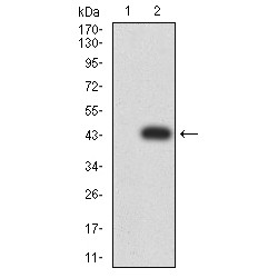 Isocitrate Dehydrogenase 1, Soluble (IDH1) Antibody