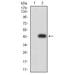 Complement Component 1q Subcomponent A (C1qA) Antibody