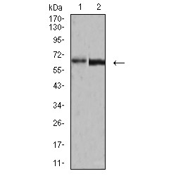 Structural Polyprotein (VP2) Antibody
