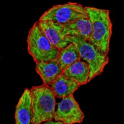 P2X Purinoceptor 7 (CPV-VP2) Antibody