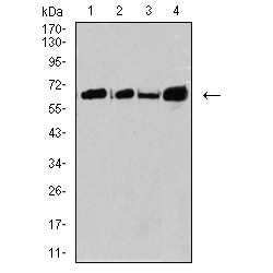 P2X Purinoceptor 7 (CPV-VP2) Antibody