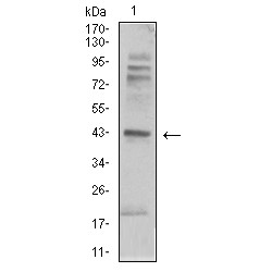 Beta-2 Adrenergic Receptor (ADRB2) Antibody