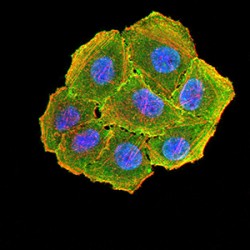 Cyclin D1 (CCND1) Antibody