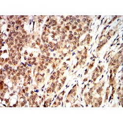 Cyclin D1 (CCND1) Antibody