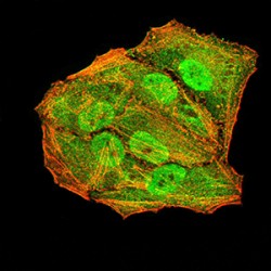 Anaphase-Promoting Complex Subunit 10 (ANAPC10) Antibody