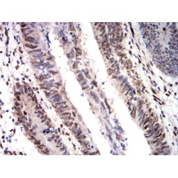 Cold-Inducible RNA-Binding Protein (CIRBP) Antibody
