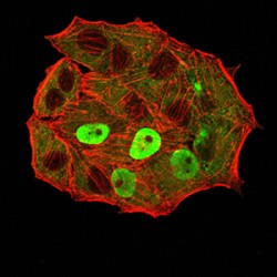 Estrogen Receptor Alpha (ESR1) Antibody