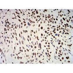 Estrogen Receptor Alpha (ESR1) Antibody