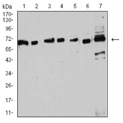 Estrogen Receptor Alpha (ESR1) Antibody