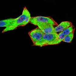 Complement Factor H-Related Protein 5 (CFHR5) Antibody