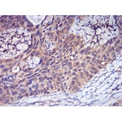 Complement Factor H-Related Protein 5 (CFHR5) Antibody