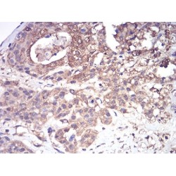 Complement Factor H-Related Protein 5 (CFHR5) Antibody