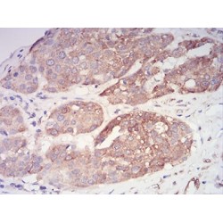 PYD And CARD Domain Containing (PYCARD) Antibody
