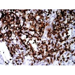 T-Cell Surface Antigen CD2 (CD2) Antibody