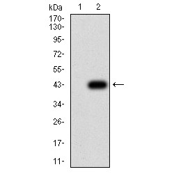 Beta-2 Adrenergic Receptor (ADRB2) Antibody