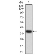 Western blot analysis of recombinant human ADORA2A (274-412 AA). Expected MW is 37 kDa.