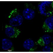 Immunofluorescence staining of Neuro2a mouse neuroblastoma cell line using anti-betaIII-tubulin (FITC, green, 1 µg/ml). Nuclei were stained with DAPI (blue).