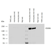 WB analysis of various monocyte lysates, THP-1 and Raji cells, under reducing and non-reducing conditions using MRC1 antibody, 2 μg/ml. Estimated band size ~206 kDa.