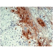 IHC-F analysis of Human pituitary gland using beta Endorphin antibody.