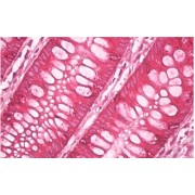 IHC-P analysis of human colon tissue, using anti-AGR2+AGR3