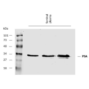 WB analysis of Human seminal plasma under reducing conditions, using KLK3 antibody 5 µg/ml, followed by IRDye800-conjugated Mouse secondary antibody. Approximate band for Human KLK3 was detected at 30 kDa.