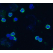 abx140226