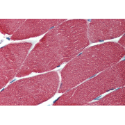 Immunohistochemistry staining of human muscle (paraffin-embedded sections) with anti-muscle-specific actin.