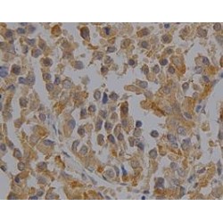 Peroxiredoxin 6 (PRDX6) Antibody
