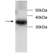 WB analysis of recombinant Peroxiredoxin 6 (PRDX6) protein, using Peroxiredoxin 6 (PRDX6) antibody (1/1000 dilution) Peroxiredoxin 6 detection is demonstrated by the arrow.