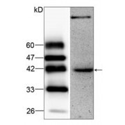 WB analysis of HepG2 whole cell lysates, using HKR2/ZSCAN22 antibody (1/1000 dilution).