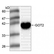 WB analysis of HepG2 whole cell lysate, using Aspartate Aminotransferase, Mitochondrial (GOT2) Antibody (1/1000 dilution).