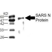 WB analysis of recombinant SARS N Protein, using SARS N Protein Antibody (1/1000 dilution).