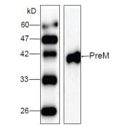 WB analysis of recombinant JEV protein with JEV PreM antibody (1/1000 dilution).