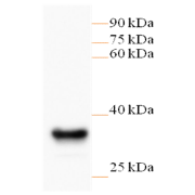 WB analysis of transgenic rice protein, using G418 antibody (1/1000 dilution).