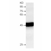 WB analysis of CP4-EPSPS expression in transgenic soybean, using CP4-EPSPS antibody (1/1000 dilution).