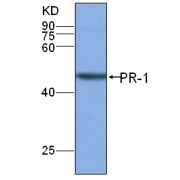 WB analysis of PR-1 expression in rice (CV. 9311) leaf at the flowering stage, using PR-1 antibody (1/1500 dilution)