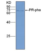 WB analysis of protein PR-pha expression in rice (CV. 9311) leaf at the tillering stage, using PR-pha Antibody (1/2000 dilution)