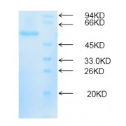 12% SDS-PAGE analysis of recombinant HSD17B10 protein. Vector: pEGH.