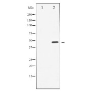Western blot analysis of Cyclin E1 expression in Paclitaxel treated HeLa whole cell lysates, The lane on the left is treated with the antigen-specific peptide.
