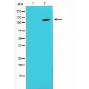 Western blot analysis of LOVO using HIF1a antibody. The lane on the left is blocked with the antigen-specific peptide.