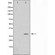Western blot analysis of Jurkat cell lysate using GADD153 Antibody.