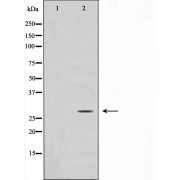 Western blot analysis of Jurkat cell lysate using GADD153 Antibody.