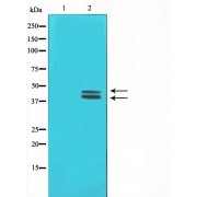 Western blot analysis of COLO205 cell lysate using ERK1/2 Antibody.