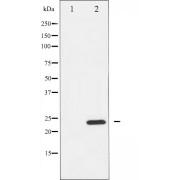 Western blot analysis of RhoA expression in HeLa whole cell lysates, The lane on the left is treated with the antigen-specific peptide.