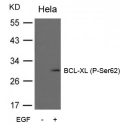 BCL-XL (pS62) Antibody