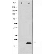 Western blot analysis of extracts from COLO cells, using Caspase 3 (p17, Cleaved-Asp175) Antibody. The lane on the left is treated with the synthesized peptide.