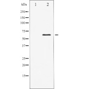 Western blot analysis of Elk1 expression in heatshock treated HeLa whole cell lysates, The lane on the left is treated with the antigen-specific peptide.