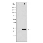 Western blot analysis of TIMP1 expression in 293 whole cell lysates, The lane on the left is treated with the antigen-specific peptide.