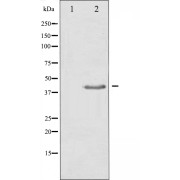 abx020036